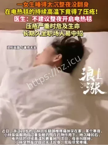 21岁女生电热毯压疮